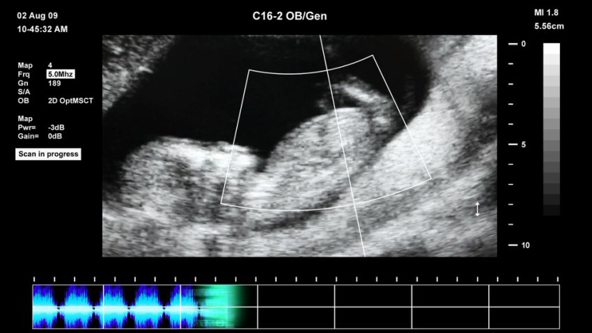 抖音快手无人直播胎教助眠全攻略：教程+软件+素材